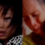 Ibu Laporkan Guru ke Polisi, Ternyata Mata Siswi SD Lebam Bukan Dianiaya: Sakit Batuk